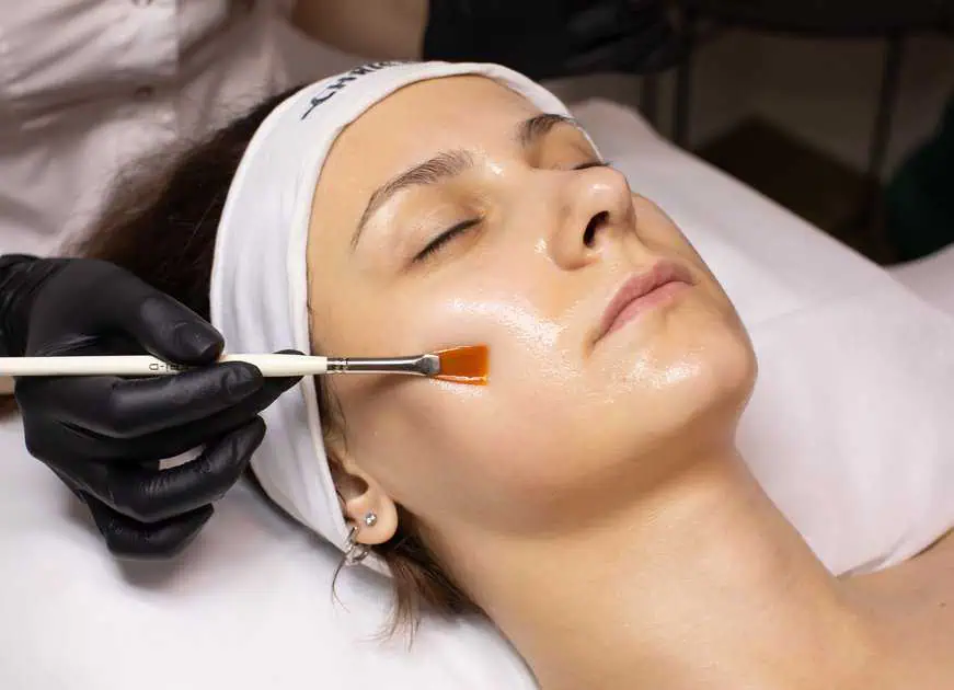 Chemical Peel by The Aesthetic Haus LLC in Mandeville, LA