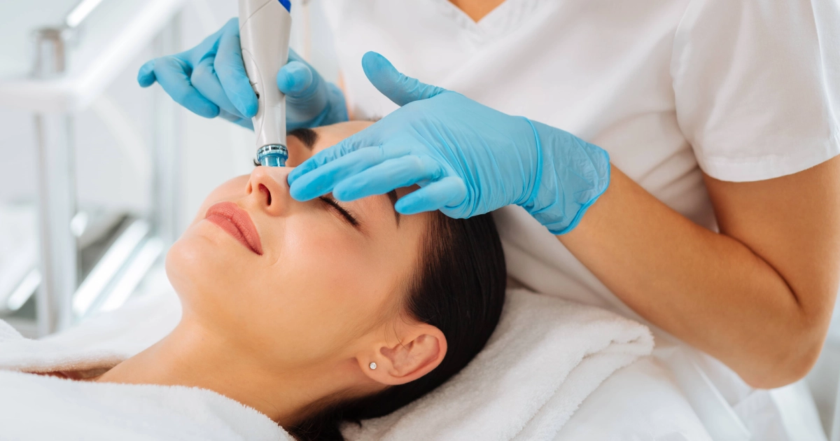 Woman receiving SkinPen Microneedling Treatments in Mandeville, LA from a professional esthetician.