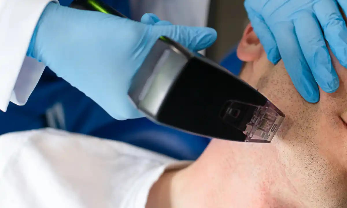 Morpheus8 Sessions in Mandeville, LA