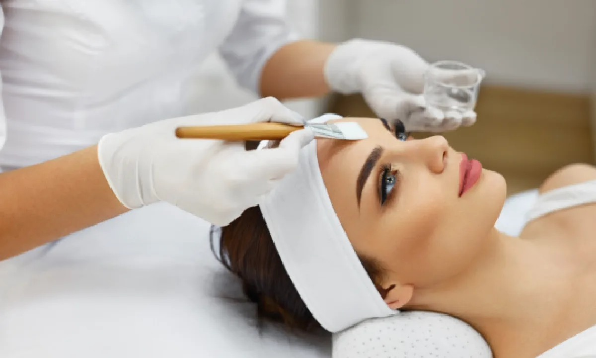 10 Benefits of a VI Peel for acne scars and hyperpigmentation